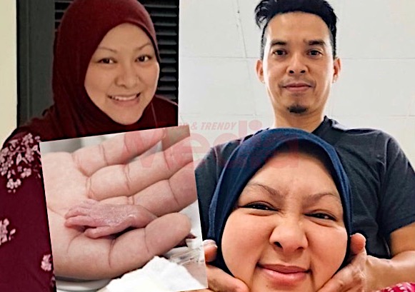 &#8220;Pernah Kritikal 90 Peratus Bergantung Pada Mesin, Lepas Tu Turun 65 Peratus. Hari Ni Dah Turun Lagi 50 Peratus,&#8221; &#8211; Abby Abadi Kongsi Perkembangan Baby D