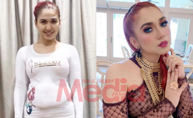 &#8220;Pernah Elak Untuk Bergambar, Sedar Diri Hodoh,&#8221; &#8211; Beby Maembong Kini Berjaya Turun 18Kg!