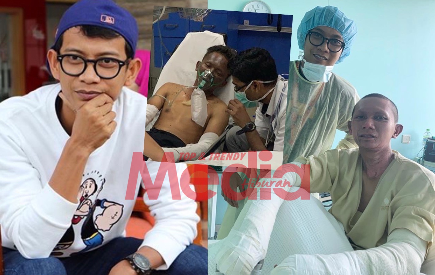 Makin Pulih Dari Melecur Tahap Dua, “Alhamdulillah Cantik Dah Kau,” – Ajak Kongsi Foto Terkini Adik