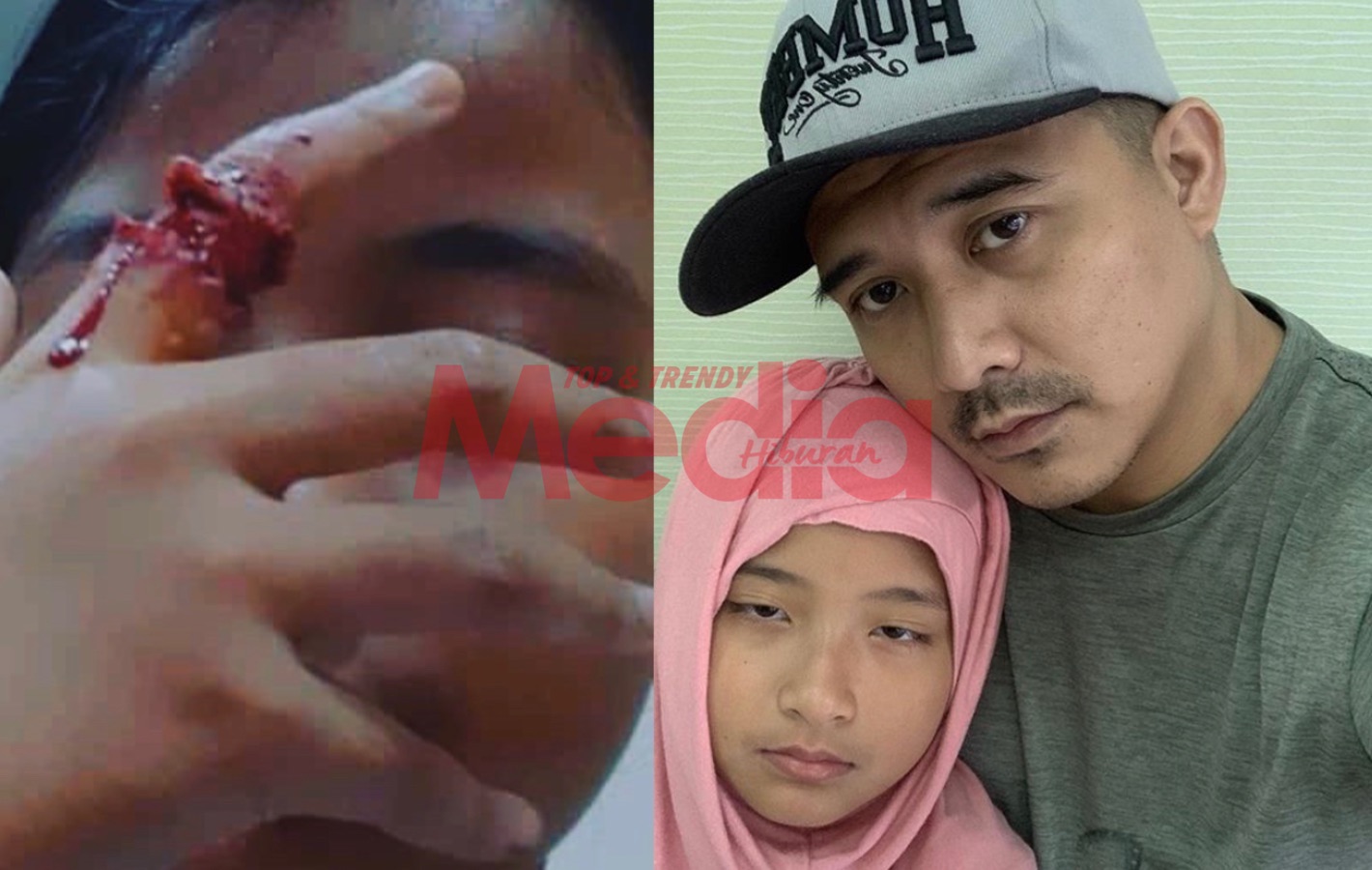 “Selalu Buat Kejutan Beruk&#8230;,” &#8211; Aaron Aziz Terkejut Melihat Jari Anak