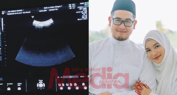 “Beberapa Bulan Saja Lagi, Berdebar Rasanya,”- 6 Bulan Kahwin, Dayana & Hadi Mazlan Bakal Timang Anak Sulung