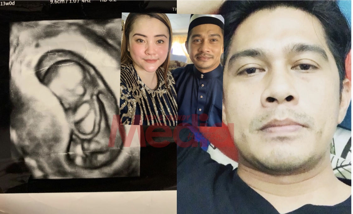 "Papa Tak Nagis, Papa Kuat," - Kandungan 14 Minggu Keguguran, Fizz Fairuz Reda