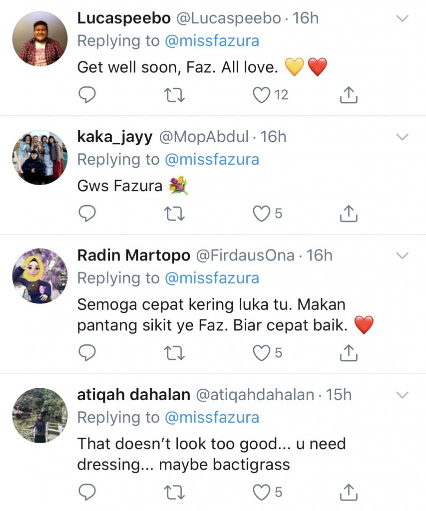 “Tak Lama Lagi Sembuh Ni,” &#8211; Tangan Tercedera Kerana Minyak Panas, Fazura Kongsi Gambar Terkini