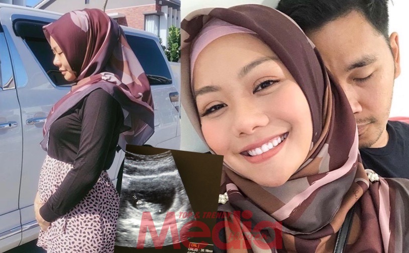 “Dah 10 Minggu Baby Duk Diam Dalam Perut I,” – Belum Alami Alahan Ibu Hamil, Hos Anim Ezati Kini Berbadan Dua