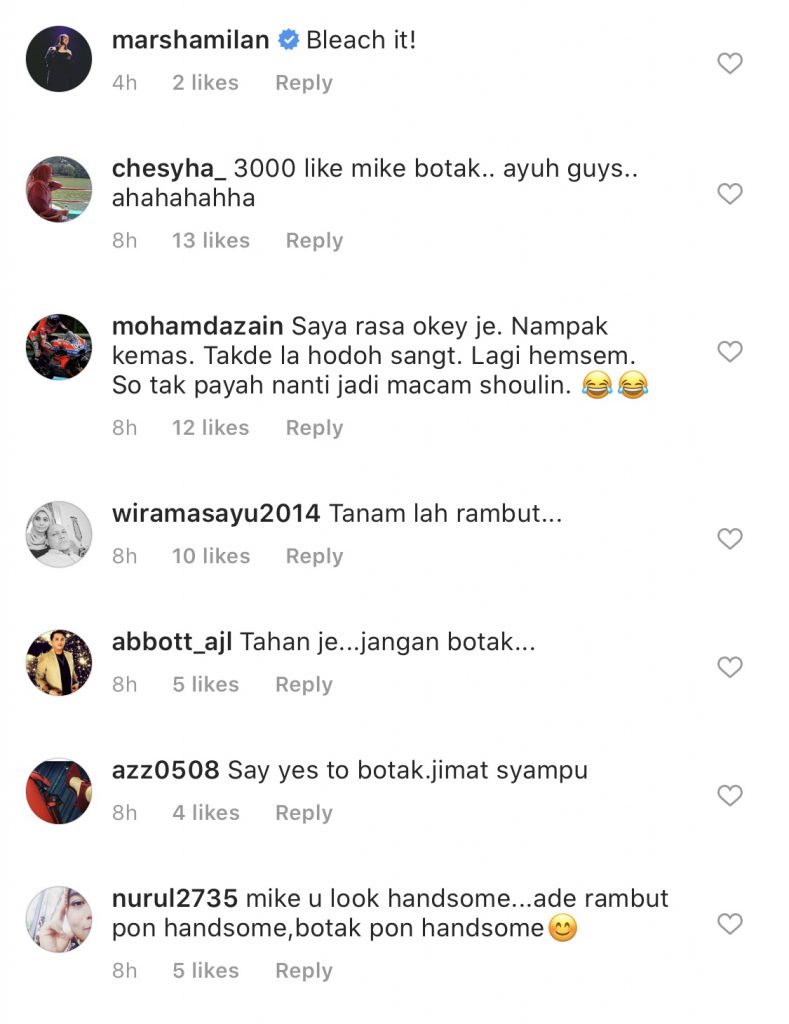 “Stress Dengan Rambut Aku,”- Michael Ang Tanya Perlu Atau Tidak Dia Botakkan Kepala Gara-Gara…