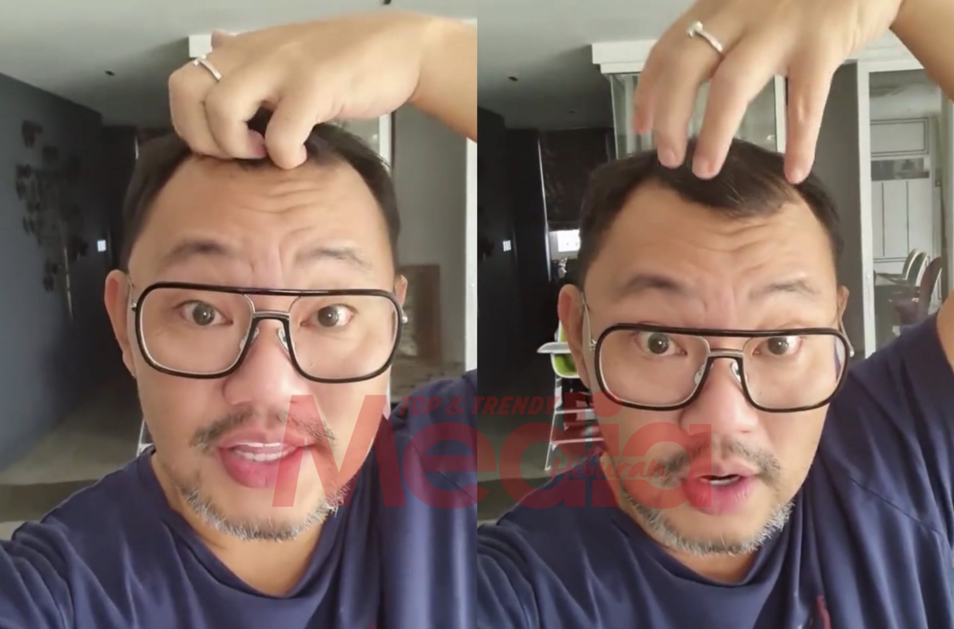 “Stress Dengan Rambut Aku,”- Michael Ang Tanya Perlu Atau Tidak Dia Botakkan Kepala Gara-Gara&#8230;