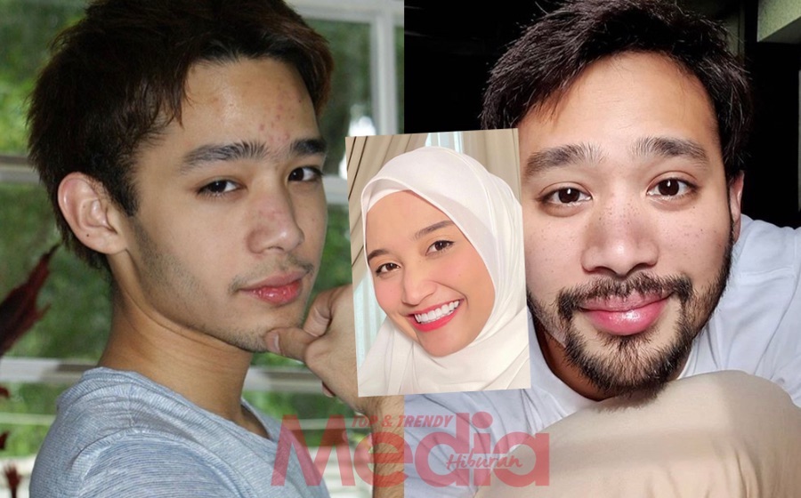 “Macam-Macam Produk Muka Pakai, Tapi Lepas Baik Jer, Set Jerawat Baru Akan Tumbuh,” &#8211; Nabil Mahir Tunjuk Foto Lama, Ini Pula Respon Balas Si Tunang, Ayda Jebat!