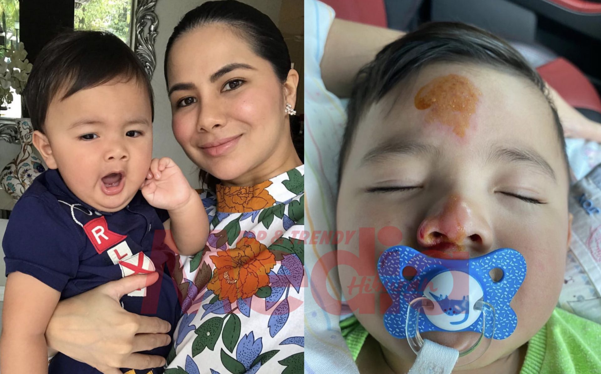 “Jatuh Tersembam Muka Kat Jalan Tar,” – Noor Nabila Sedih Lihat Keadaan Anak Jebat Jayden Alami Luka