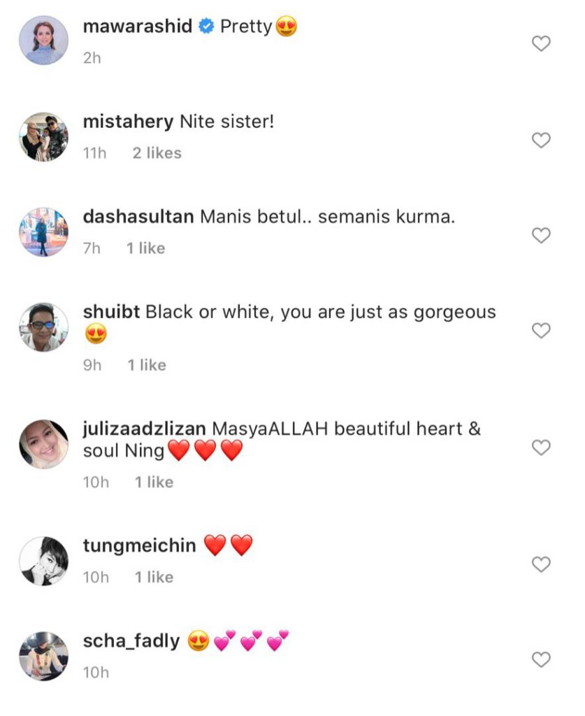“Bukan Ke Kulit Dia Hitam Manis,”- Kulit Wajah Semakin Putih, Ini Jawapan Ning Baizura. Rupa-Rupanya…