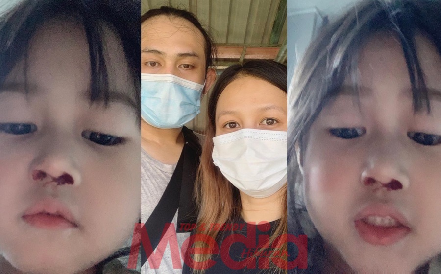 “Siap Ambil Gambar Sendiri Mahu Tengok…,” – Hidung Anak Stacy Sensitif, Mudah Keluar Darah