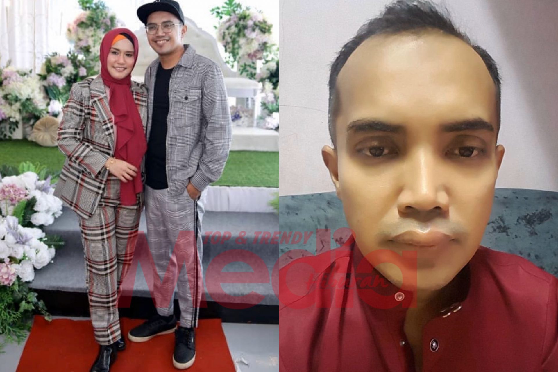 “Saya Tak Buat Apa-Apa Dekat Ezad,” – Bibir Ezad Lazim Membengkak, Isteri Berkejar Dapatkan Rawatan Tengah Malam