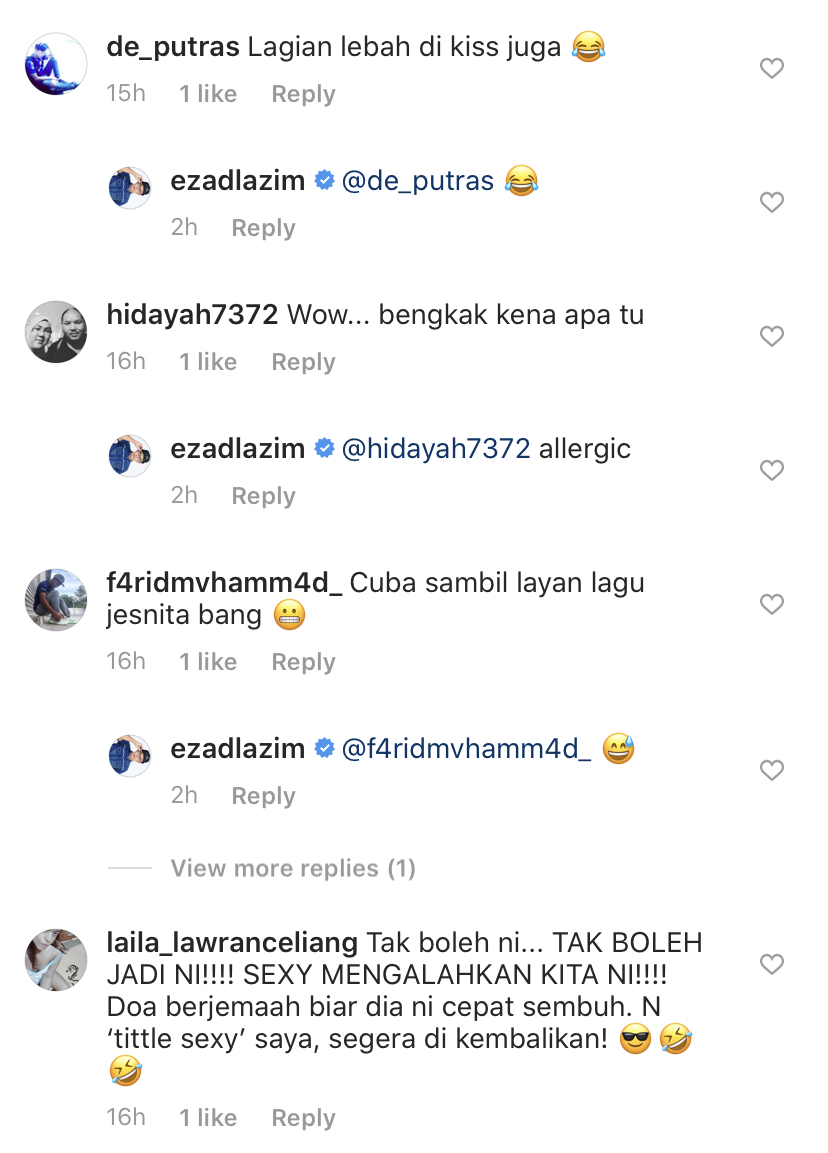 “Saya Tak Buat Apa-Apa Dekat Ezad,” – Bibir Ezad Lazim Membengkak, Isteri Berkejar Dapatkan Rawatan Tengah Malam