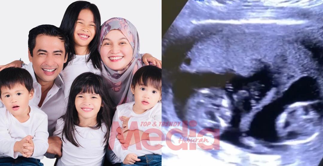 Bakal Terima Kembar Kali Ketiga, Dr. Halina Kongsi Video Ultra Sound