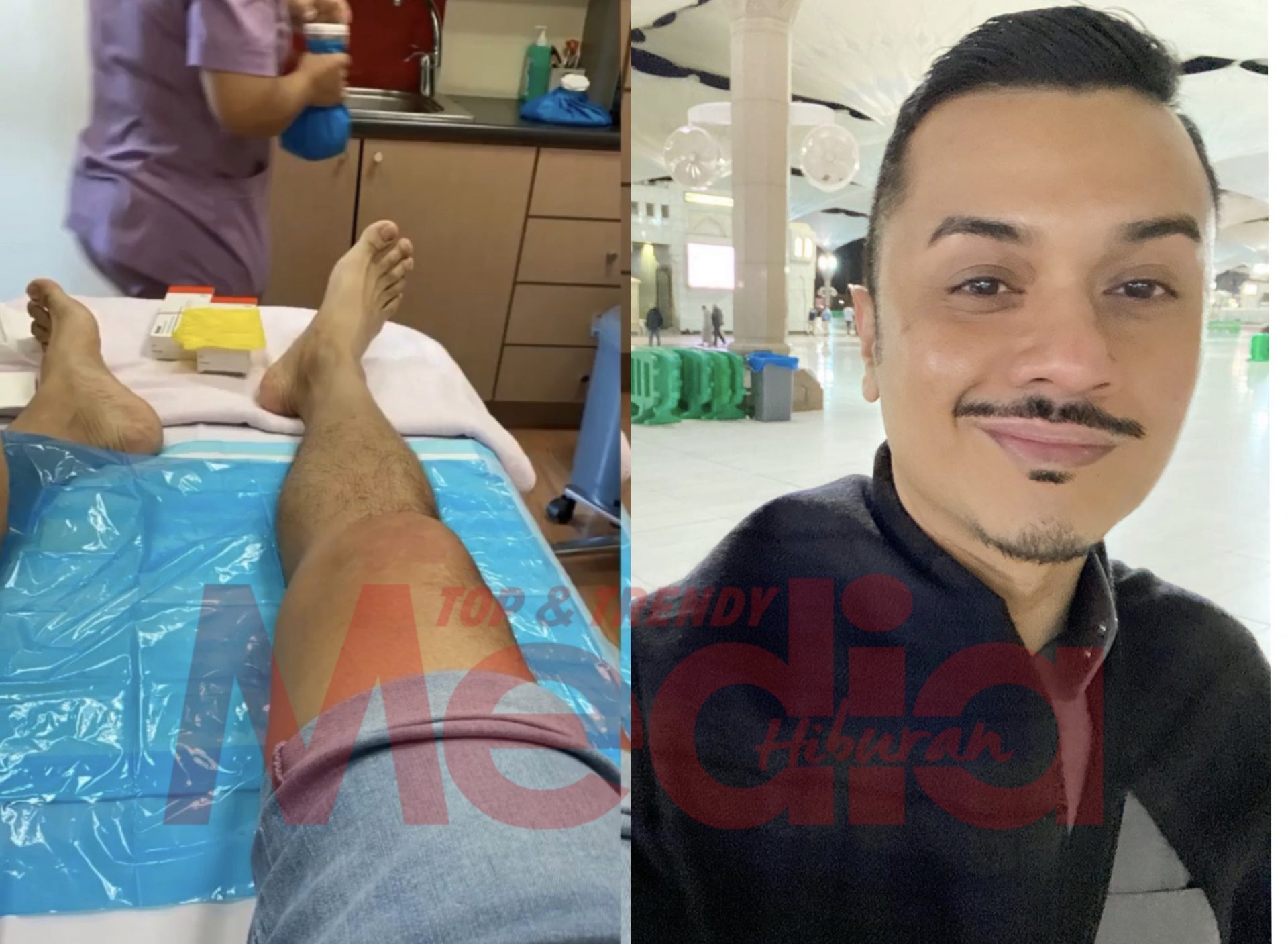 “Dah Beberapa Hari Solat Duduk,” – Datuk Fazley Tercedera Di Bahagian Lutut Sebab…