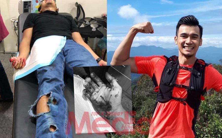 Kongsi Foto Seluar Koyak & Tangan Berlumuran Darah, Pelakon Fazreen Rafi Terlibat Dalam Kemalangan