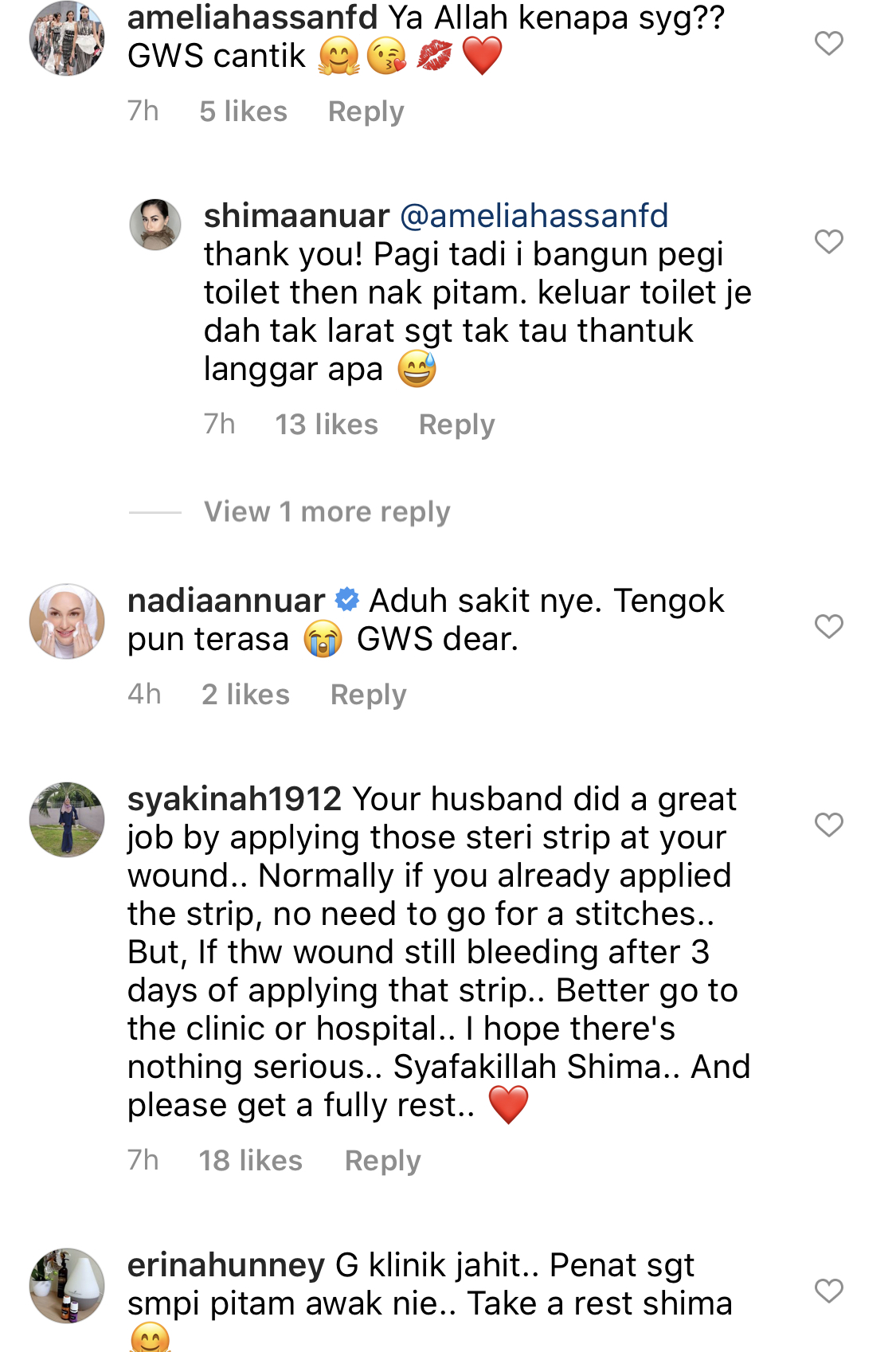 “Sewel Jap Tak Ingat Apa,”- Dahi Shima Anuar ‘Terbelah’ Gara-Gara Pitam Di Rumah, Elak Pergi Klinik Sebab Takut Kena Jahit