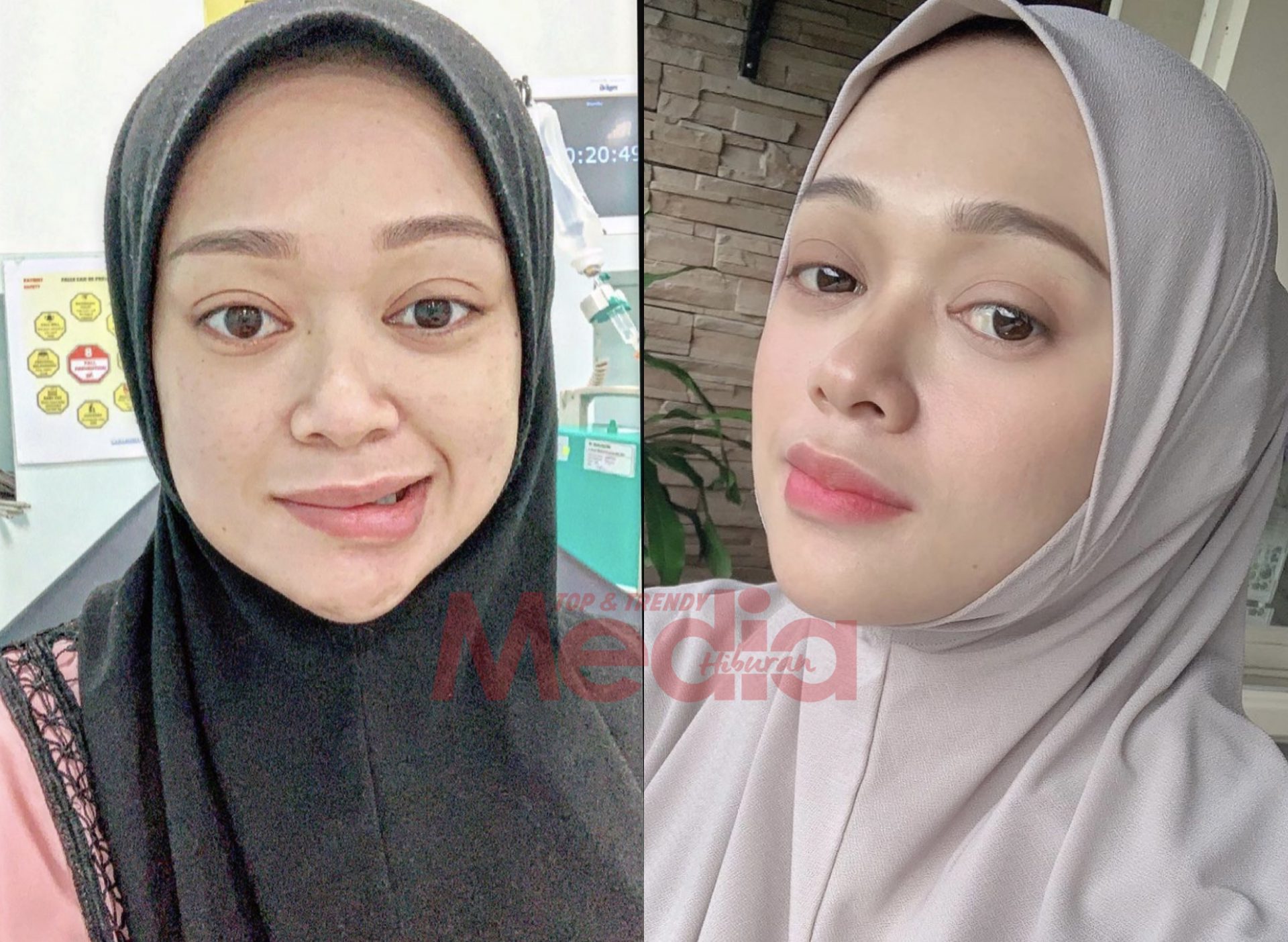 Pernah Diserang Penyakit Bell Palsy, Faye Kusairi Anggap Sebagai&#8230; ‘Kenangan Manis Yang Tak Akan Saya Lupakan.’