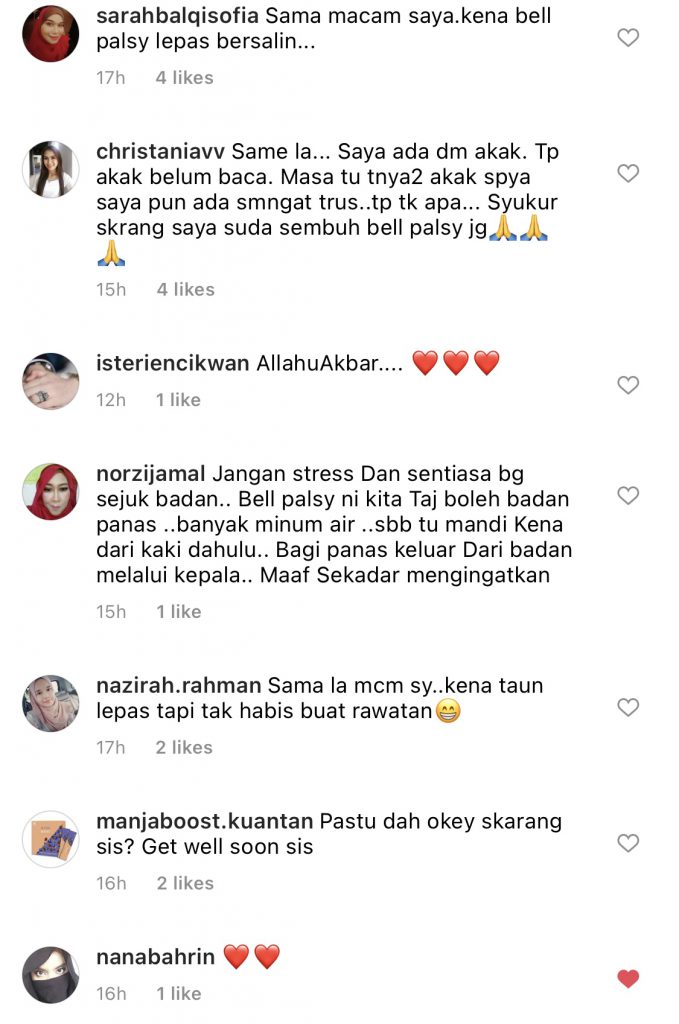 Pernah Diserang Penyakit Bell Palsy, Faye Kusairi Anggap Sebagai&#8230; ‘Kenangan Manis Yang Tak Akan Saya Lupakan.’