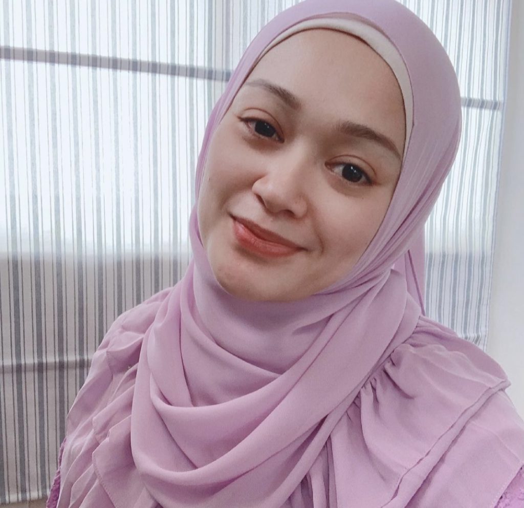Pernah Diserang Penyakit Bell Palsy, Faye Kusairi Anggap Sebagai… ‘Kenangan Manis Yang Tak Akan Saya Lupakan.’