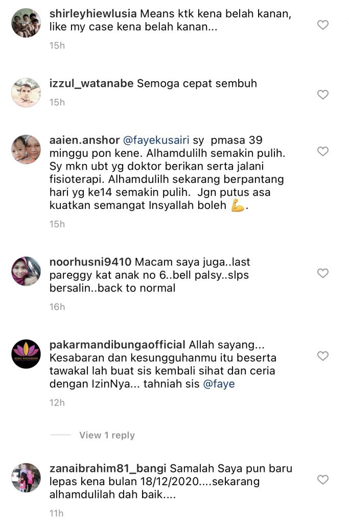 Pernah Diserang Penyakit Bell Palsy, Faye Kusairi Anggap Sebagai&#8230; ‘Kenangan Manis Yang Tak Akan Saya Lupakan.’